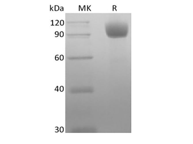 Recombinant Mouse Angiotensin-Converting Enzyme 2/ACE-2 (C-10His) - ABMIUM