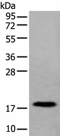 Western blot analysis of Human urinary bladder tissue lysate using MYL12B Polyclonal Antibody at dilution of 1:250