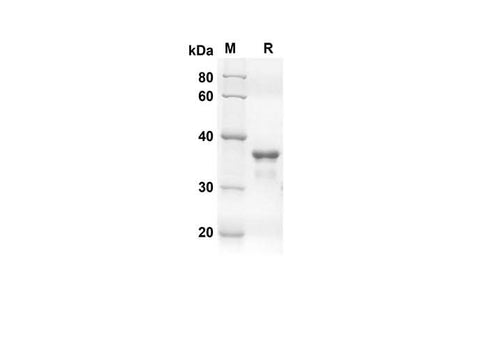 SDS-PAGE analysis of Human TARC proteins, 2 μg/lane of Recombinant Human TARC proteins was resolved with an SDS-PAGE under reducing conditions, showing bands at 35.2 kDa.