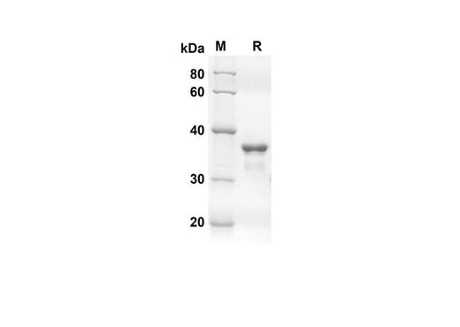 SDS-PAGE analysis of Human TARC proteins, 2 μg/lane of Recombinant Human TARC proteins was resolved with an SDS-PAGE under reducing conditions, showing bands at 35.2 kDa.