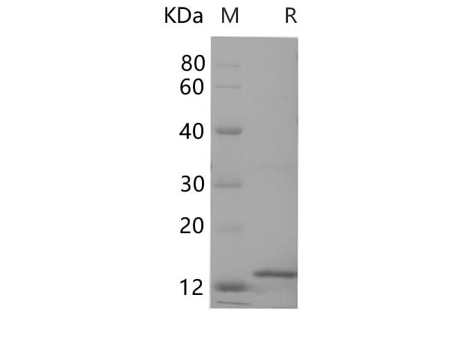 SDS-PAGE analysis of Human Cystatin C/CST3 proteins, 2 μg/lane of Recombinant Human Cystatin C/CST3 proteins was resolved with SDS-PAGE under reducing conditions, showing bands at 14 kDa.