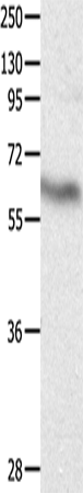 Anti-Human/Mouse/Rat DPYSL4 Antibody - ABMIUM