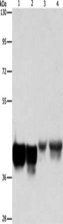 Anti-Human/Mouse/Rat AUP1 Antibody - ABMIUM