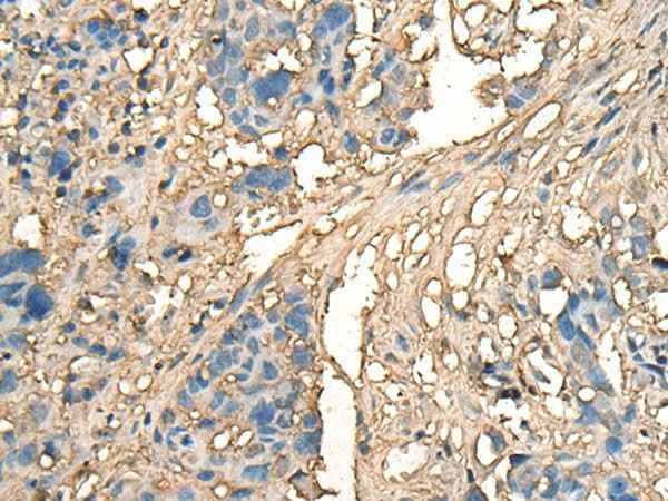 Anti-Human/Mouse/Rat CELA1 Antibody