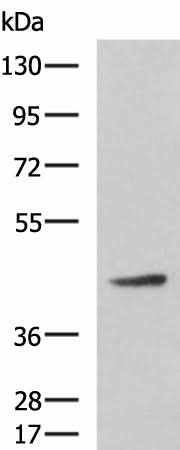 Western blot analysis of Hela cell lysate using ARPC1B Polyclonal Antibody at dilution of 1:800