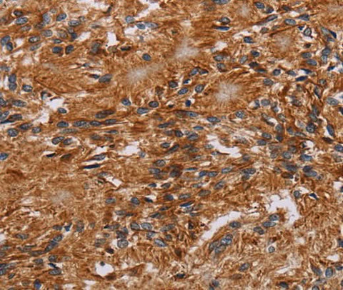 Anti-Human JAKMIP2 Antibody - ABMIUM