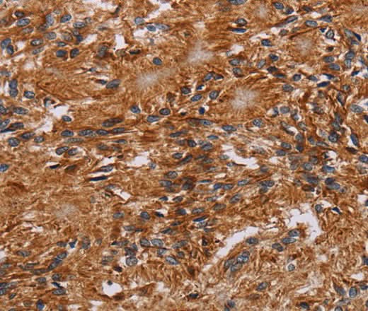 Anti-Human JAKMIP2 Antibody - ABMIUM