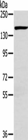 Anti-Human/Mouse PLXND1 Antibody - ABMIUM