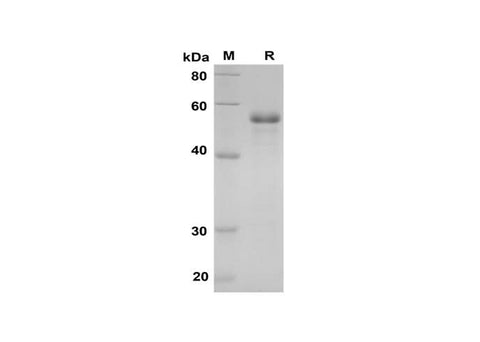SDS-PAGE analysis of Human SPARC proteins, 2 μg/lane of Recombinant Human SPARC proteins was resolved with SDS-PAGE under reducing conditions, showing bands at 52 kDa.
