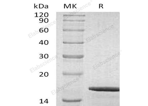Recombinant Human GDNF Protein - ABMIUM