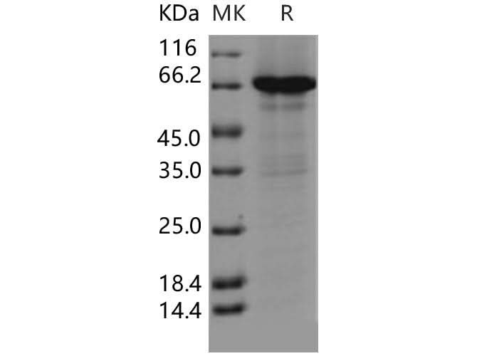 > 82 % as determined by reducing SDS-PAGE.