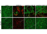 4T1 cells and Hela cells were treated with 5 % DMSO, 5μM Camptothecin, 10μM Camptothecin for 4h, then stained with Calcein-AM / PI Double Staining Kit and photographed.