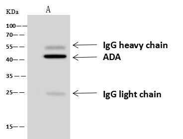 Anti-Human ADA Antibody [A905] - ABMIUM