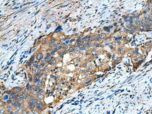 Anti-Human/Mouse COMMD9 Antibody