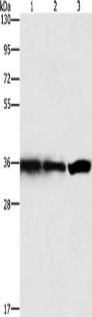Anti-Human/Mouse/Rat GNB1 Antibody - ABMIUM