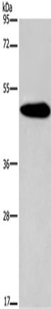 Anti-Human/Mouse/Rat KCNG2 Antibody - ABMIUM