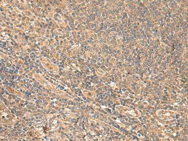 Anti-Human/Mouse/Rat MEST Antibody