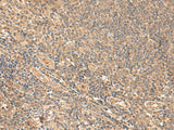 Immunohistochemistry of paraffin-embedded Human tonsil tissue using MEST Polyclonal Antibody at dilution of 1:65(×200)