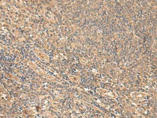 Anti-Human/Mouse/Rat MEST Antibody