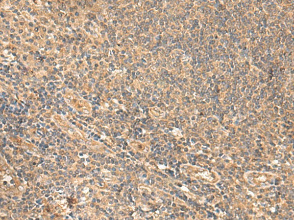 Immunohistochemistry of paraffin-embedded Human tonsil tissue using MEST Polyclonal Antibody at dilution of 1:65(×200)