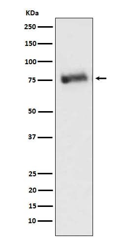 Anti-GRK3 Monoclonal Antibody Boster Bio