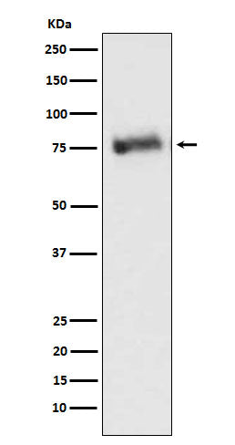 Anti-GRK3 Monoclonal Antibody Boster Bio