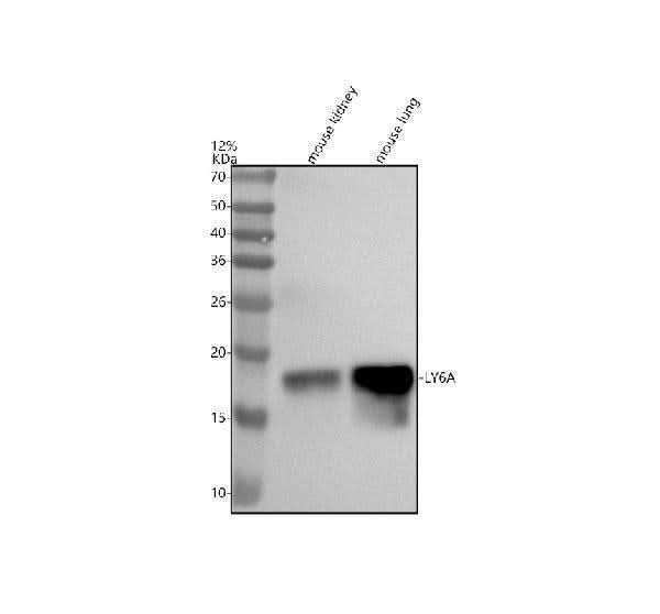 Anti-LY6A/Sca1 Rabbit Monoclonal Antibody Boster Bio