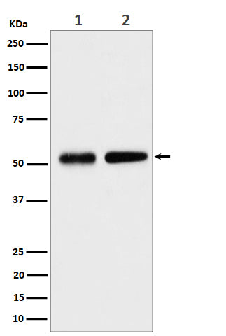 Anti-Septin 8 Rabbit Monoclonal Antibody Boster Bio