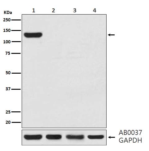 Anti-CRISPR-Cas9 Rabbit Monoclonal Antibody Boster Bio