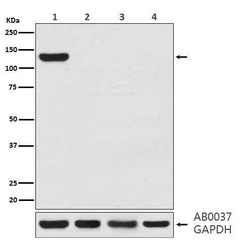 Anti-CRISPR-Cas9 Rabbit Monoclonal Antibody Boster Bio