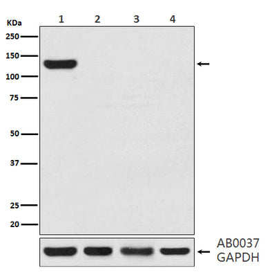 Anti-CRISPR-Cas9 Rabbit Monoclonal Antibody Boster Bio
