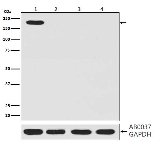 Anti-CRISPR-Cas9 SP Rabbit Monoclonal Antibody Boster Bio