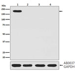 Anti-CRISPR-Cas9 SP Rabbit Monoclonal Antibody Boster Bio