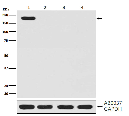 Anti-CRISPR-Cas9 SP Rabbit Monoclonal Antibody Boster Bio