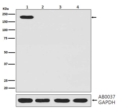 Anti-CRISPR-Cas9 SP Rabbit Monoclonal Antibody Boster Bio
