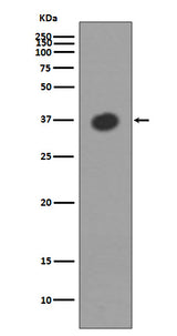 Anti-Maltose Binding Protein malE Rabbit Monoclonal Antibody Boster Bio