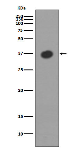 Anti-Maltose Binding Protein malE Rabbit Monoclonal Antibody Boster Bio