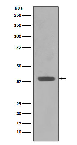 Anti-Maltose Binding Protein malE Rabbit Monoclonal Antibody Boster Bio
