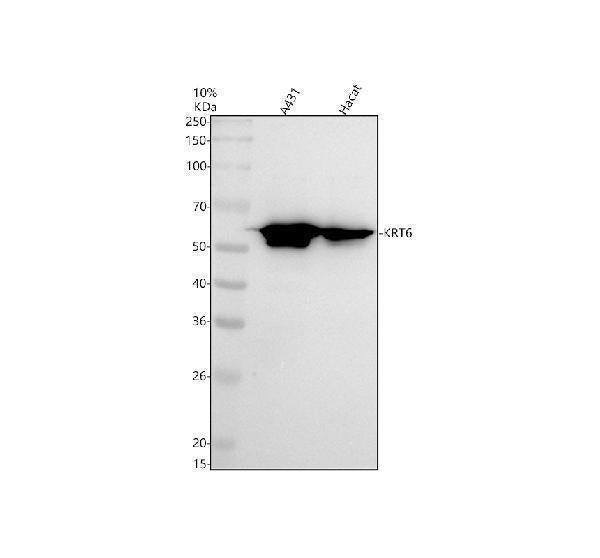 Anti-Cytokeratin 6 Rabbit Monoclonal Antibody Boster Bio