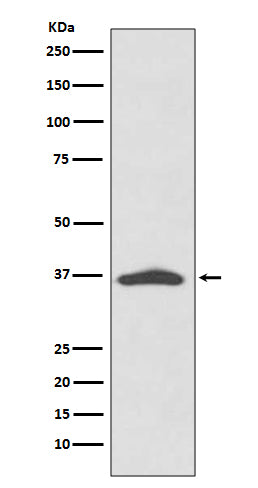 Anti-EpCAM/Trop1 Rabbit Monoclonal Antibody Boster Bio
