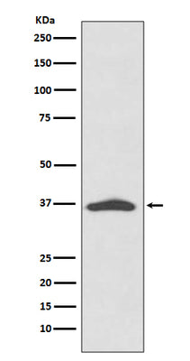 Anti-EpCAM/Trop1 Rabbit Monoclonal Antibody Boster Bio