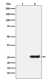 Anti-GST-Tag Mouse Monoclonal Antibody Boster Bio