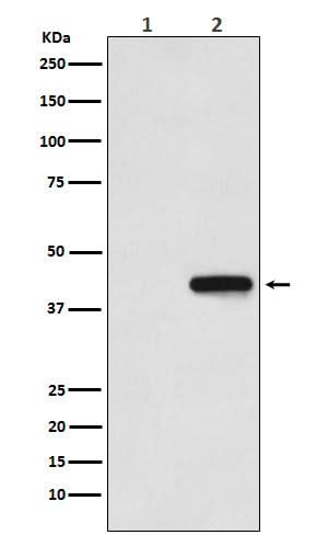 Anti-His-Tag Mouse Monoclonal Antibody Boster Bio