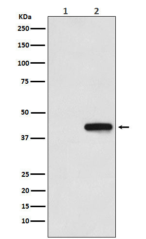 Anti-His-Tag Mouse Monoclonal Antibody Boster Bio