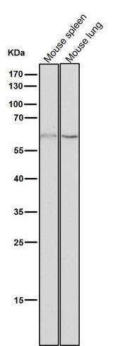 Anti-NELFB Rabbit Monoclonal Antibody Boster Bio