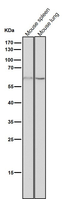 Anti-NELFB Rabbit Monoclonal Antibody Boster Bio