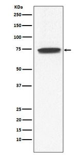Anti-GCYA3 Rabbit Monoclonal Antibody Boster Bio