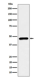 Anti-CECR5 Rabbit Monoclonal Antibody Boster Bio