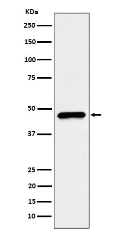 Anti-CECR5 Rabbit Monoclonal Antibody Boster Bio