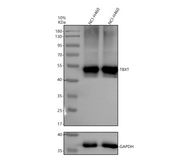 ABMIUM Free Antibody Validation – Western blot of TBXT in human NCI-H460 whole cell lysates using M31984-1; expected band at 47 kDa with GAPDH loading control